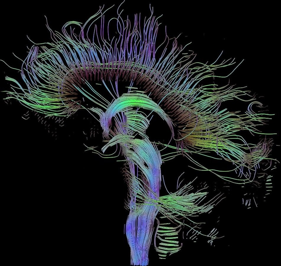Diffusion-tensor imaging of a human brain, showing reconstructed nerve-fibre tracts through the mid-sagittal plane