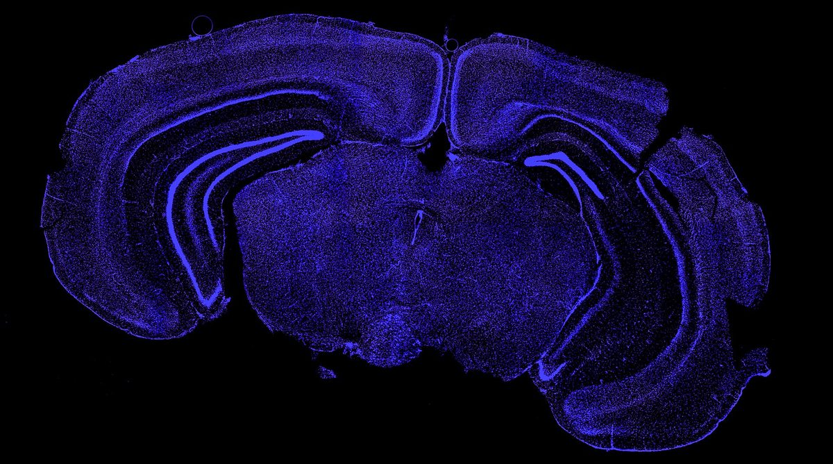 Fluorescently stained cell nuclei in a mouse brain section