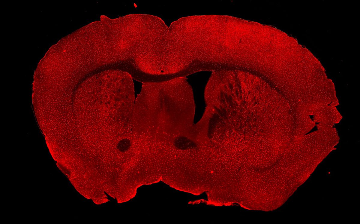 Fluorescently labelled microglia in a brain section