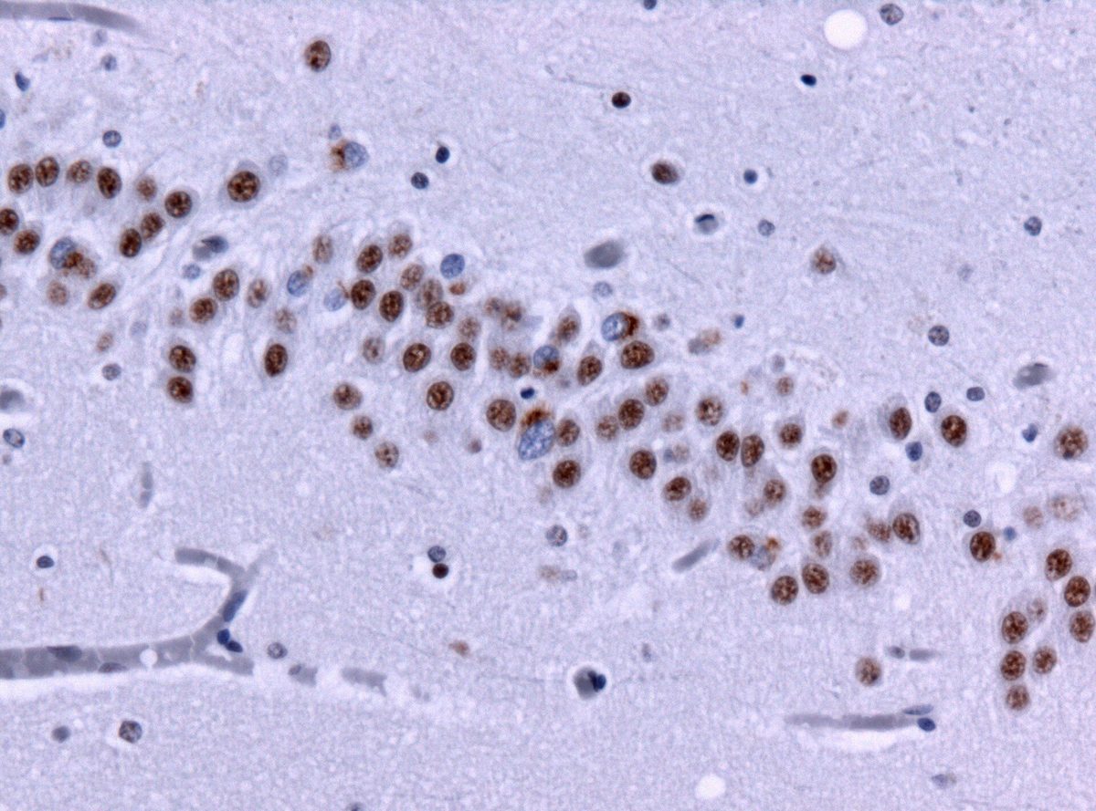 Immunohistochemistry of hippocampal tissue, stained neurons in brown