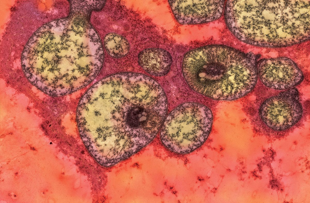 Electron micrograph of mitochondria
